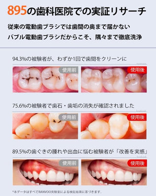 RANVOO AirJet 電動歯ブラシ ソニック RANVOO