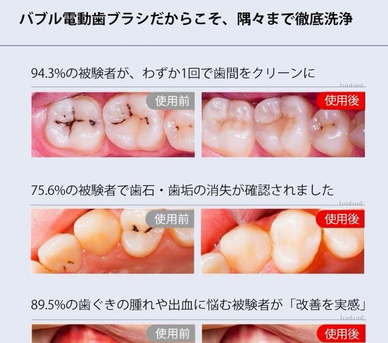 RANVOO AirJet 電動歯ブラシ ソニック RANVOO